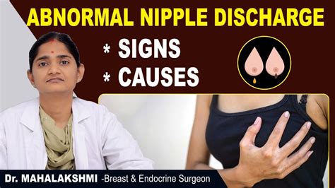 aurora nipples|Areola Abnormalities